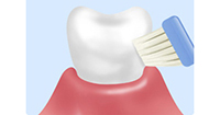 STEP2