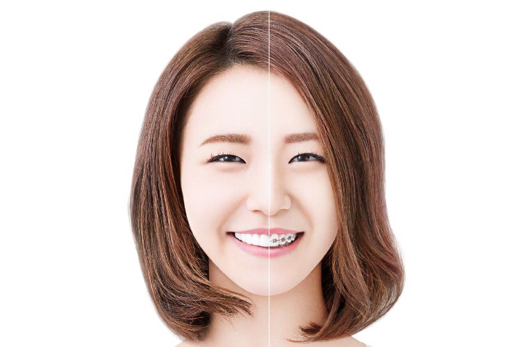 写真3