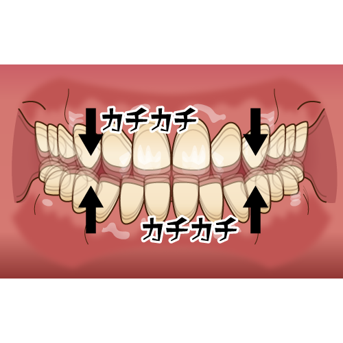 写真4