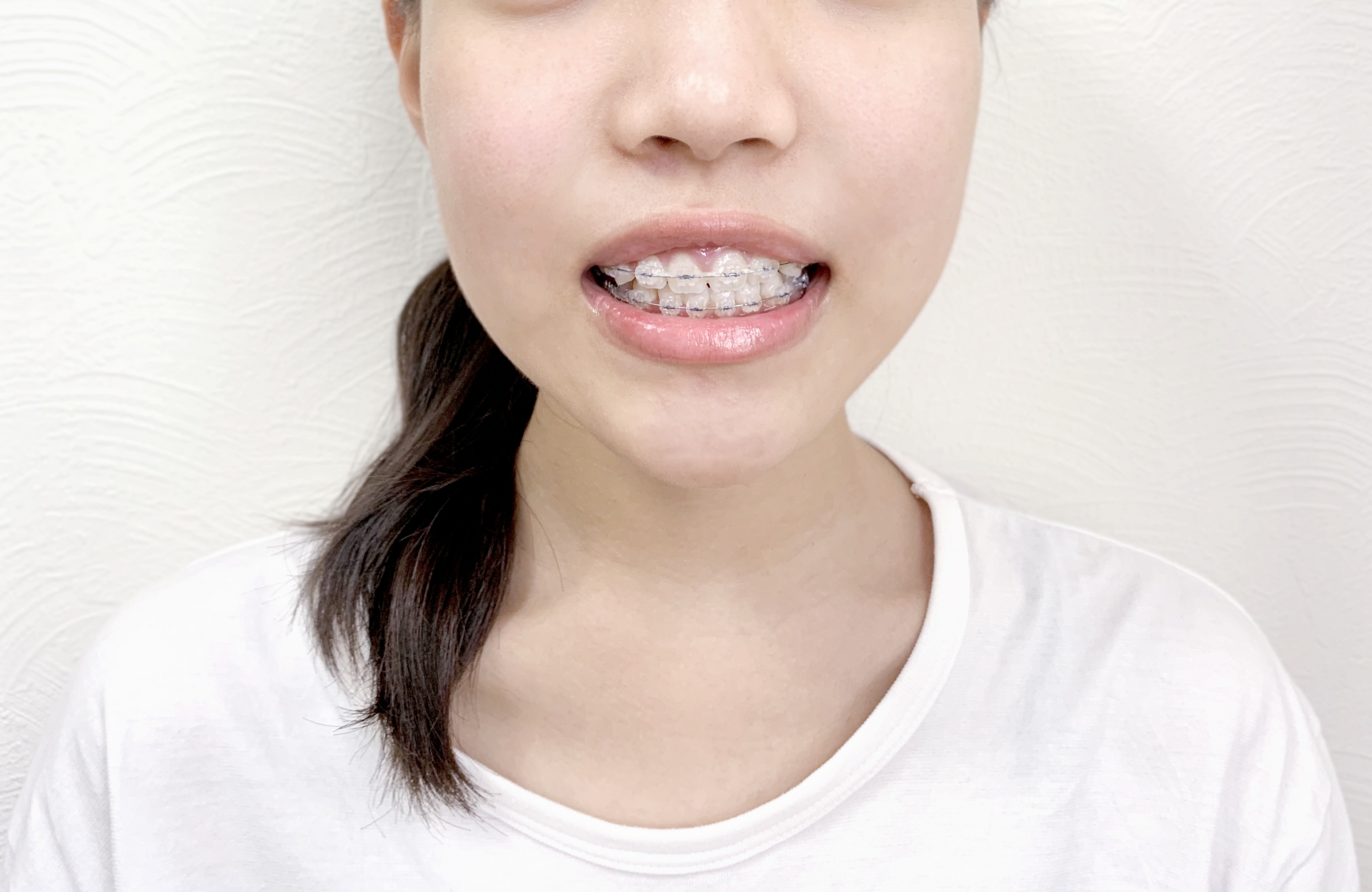 写真2