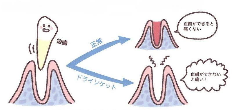 写真2
